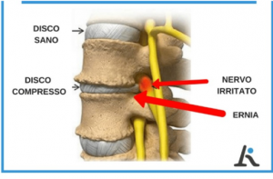 L Ernia Del Disco Studio Bodymind